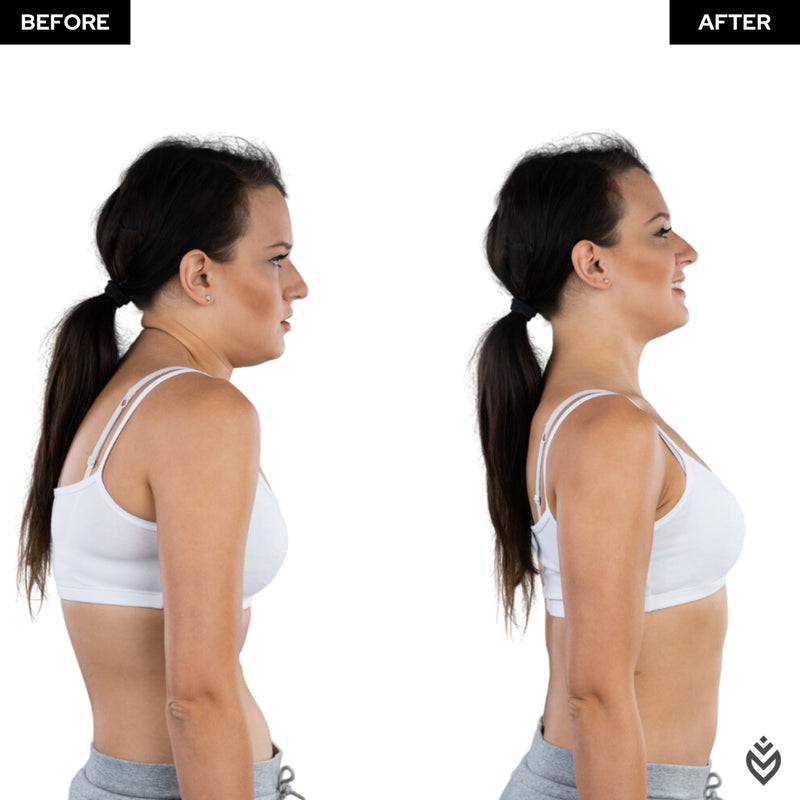 ™ Posture Corrector